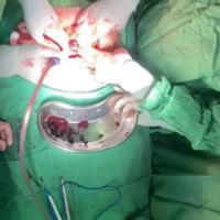 بیمار خانم 32 ساله 1 بیمار خانم 32 ساله 1