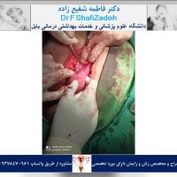 بیمار خانم 32 ساله 2 بیمار خانم 32 ساله 2